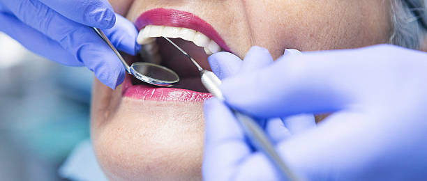 Best Emergency Tooth Extraction in Mead, WA